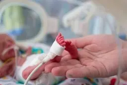  زنده شدن نوزاد لحظاتی پیش از دفن شدن