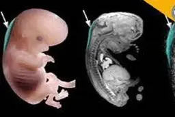 
 خوراکی های ممنوعه  برای زنان باردار +عکس
