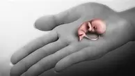 هشدار صدا و سیما به زنان درباره سقط جنین: بیمارانی که با سقط بی دلیل باعث شدند که برای همیشه شانس بارداری را از دست بدهند!+ویدئو