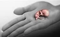 هشدار صدا و سیما به زنان درباره سقط جنین: بیمارانی که با سقط بی دلیل باعث شدند که برای همیشه شانس بارداری را از دست بدهند!+ویدئو