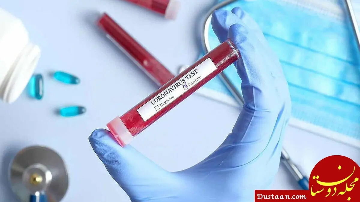 ۲ میلیون کیت تشخیص سریع ویروس کرونا از چین وارد ترکیه شد