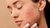 شروعی برای درخشش پوست | صبح‌هات رو هوشمندانه آغاز کن +ویدئو