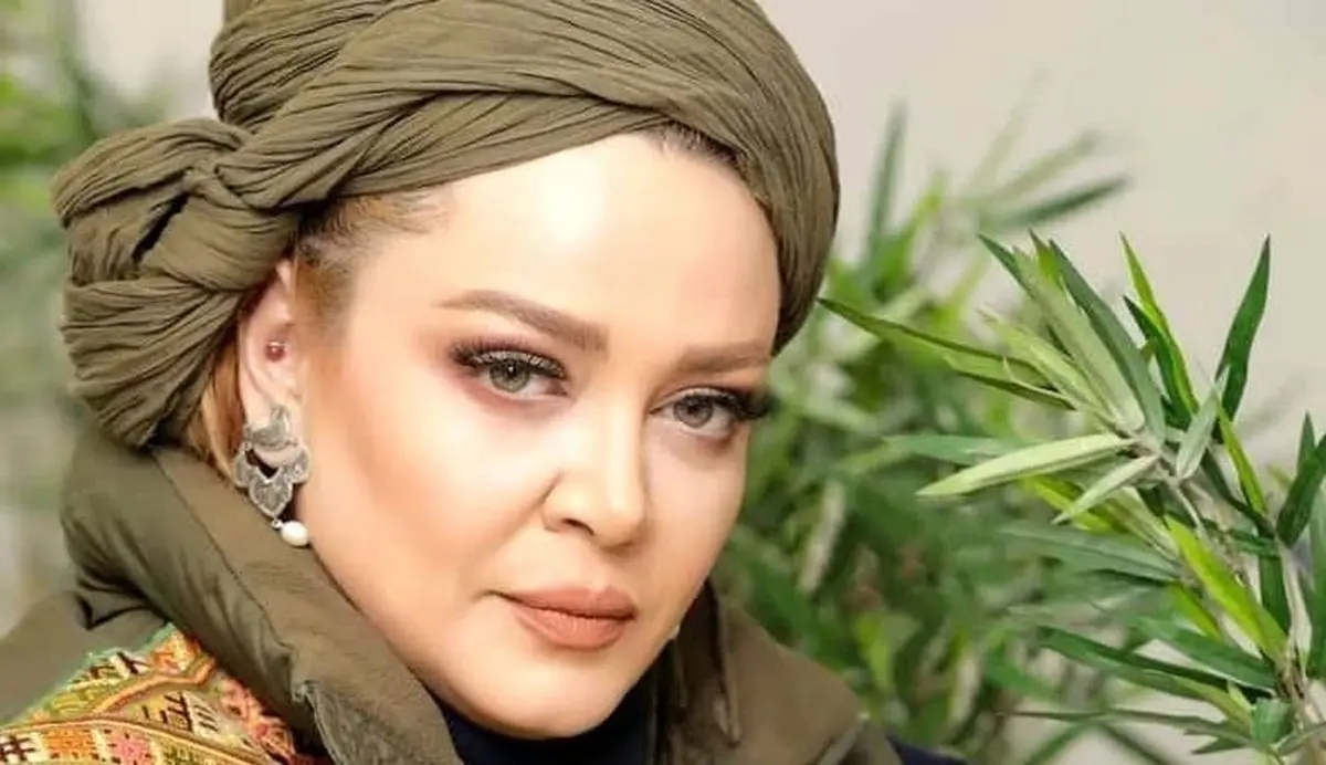 عمل های زیبایی جدید و عجیب بهاره رهنما | خانم بازیگر با این عکس همه را شوکه کرد + عکس