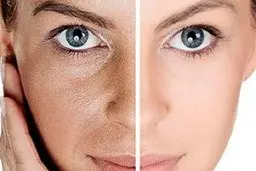 وقتی اینطوری مراقب پوستت باشی دیگه هیچوقت دچار مشکلات پوستی نمیشی!