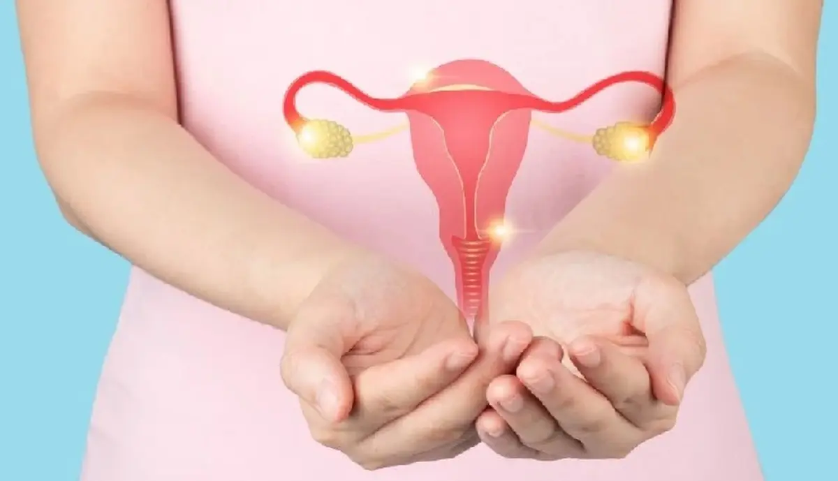 درمان خانگی تخمدان پلی کیستیک | روش بینظیر که تا بحال نمیدونستی!
