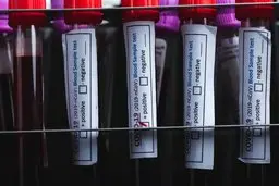 ویروس جدید کرونا در چین | هشدار درباره احتمال همه‌گیری جهانی