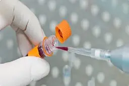 موفقیت محققان کشور در تولید کیت تشخیص کرونا