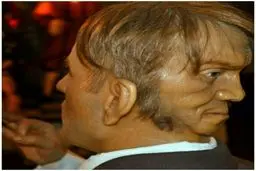 خودکشی یکی از اعضای خانواده سلطنتی انگلستان بخاطر داشتن دو چهره! | پشت گردنش هم یه صورت دیگه داشت که حرف میزد! + عکس