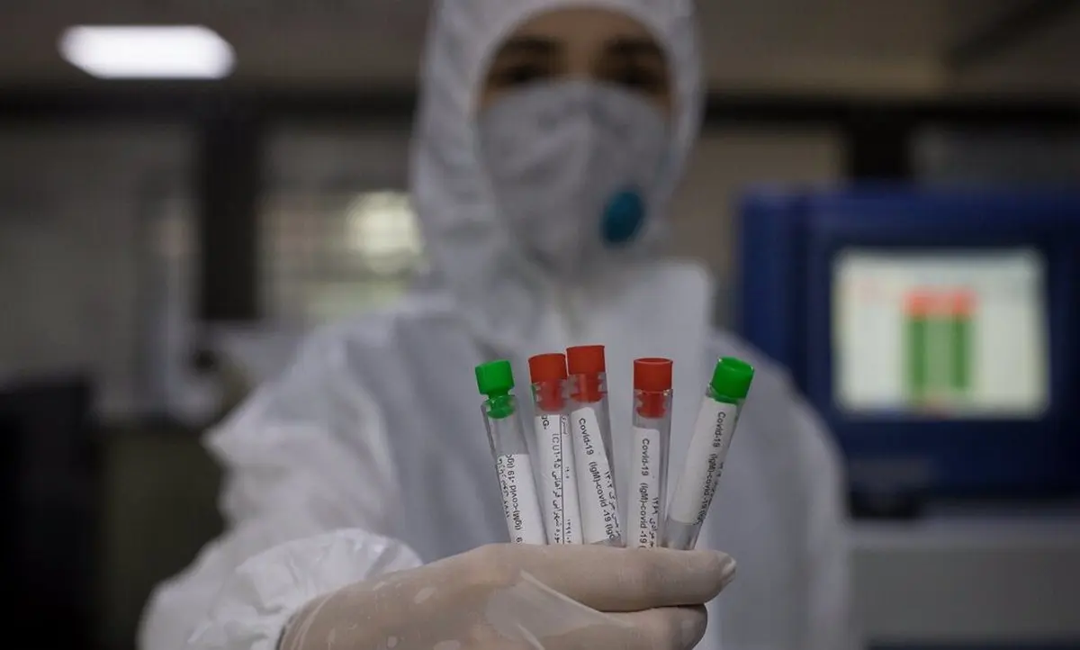
رییس سازمان غذا و دارو  |   واکسن آنفلوآنزای ایرانی سال آینده در بازار توزیع می‌شود
