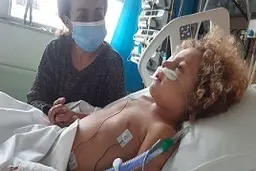 علامت جدید کرونا در کودکان؛ به کما رفتن یک کودک پس از ابتلا به کرونا