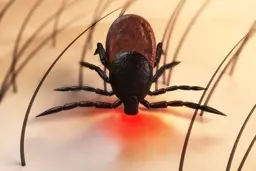  مراحل علائم بیماری لایم