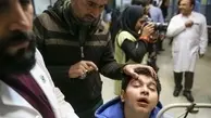 در مراسم چهارشنبه سوری از عینک محافظ استفاده شود | چشم آسیب دیده دستکاری نشود