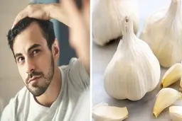 درمان ریزش مو با استفاده از معجزه ای به نام سیر