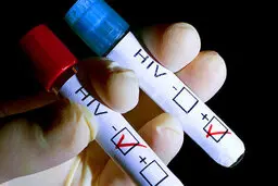 کشف جدید دانشمندان در مورد HIV