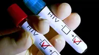 کشف جدید دانشمندان در مورد HIV