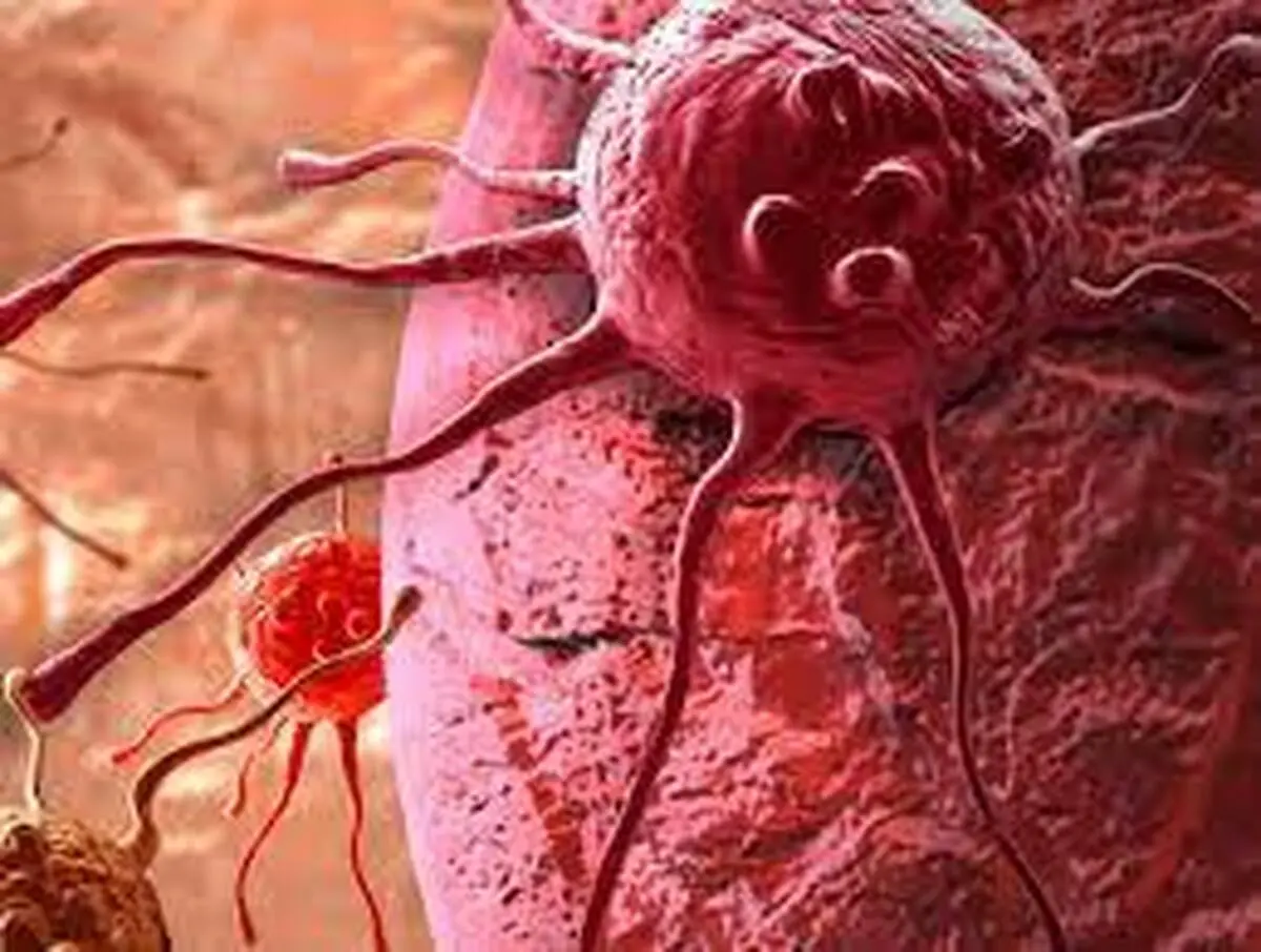 بعد از تشخیص سرطان چطور به مسافرت برویم؟ احتیاط‌های سفر برای کسانی که سرطان دارند