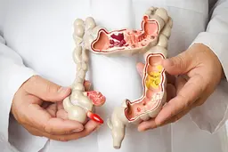 اگر یبوست دارید سمت این غذاها نروید! 