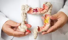 اگر یبوست دارید سمت این غذاها نروید! 