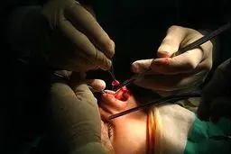 تجاوز جنسی به زن جوان زیر عمل جراحی | ماجرا چیست؟