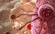 ۳ عامل بروز سرطان ها | روش های طبخ گوشت و تاثیر آن بر بروز سرطان
