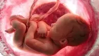 لحظه حیرت انگیز تولد یک جنین خارج از شکم مادر | این جنین با کیسه آب متولد شد!+ویدئو 