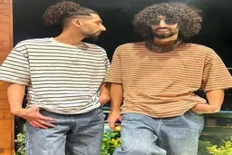 رحمان رحیم را بدون موهای فر ببینید | چهره حیرت آور دوقلوهای پایتخت+ تصویر 