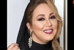  تغییر شدید چهره “بهنوش بختیاری” با عمل زیبایی