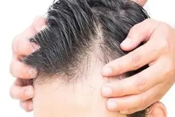 تقویت کننده های طبیعی موی سر را بشناسید!