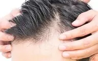 تقویت کننده های طبیعی موی سر را بشناسید!