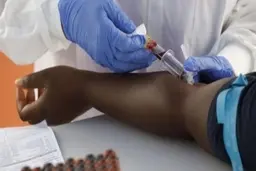  گروه خونی O کمتر در معرض خطر کووید ۱۹ هستند 