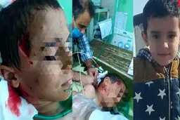 34 کودک، زن و مرد طعمه سگ‌های خیابانی | گزارش «شهروند» از آمار تکان‌دهنده حملات سگ‌های بی‌صاحب در یک‌سال گذشته