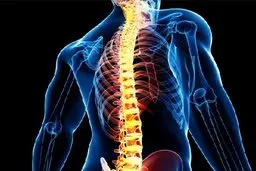 زالی: ۸۰ درصد ایرانیان فرسودگی ستون فقرات را تجربه می کنند