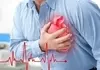 یک ماه قبل از حمله قلبی با خبر شو! | این نشانه ها را جدی بگیرید