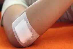انتقال کرونا ازراه زخم