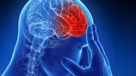 
سکته مغزی دومین عامل مرگ ایرانی‌ها / زمان طلایی درمان سکته مغزی
