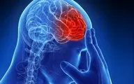 
سکته مغزی دومین عامل مرگ ایرانی‌ها / زمان طلایی درمان سکته مغزی

