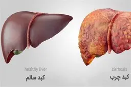 هورمون بلوغ، کبد را چرب می کند 