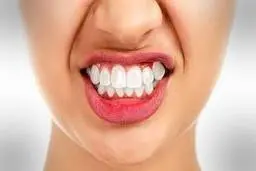 راه های درمانی برای دندان قروچه