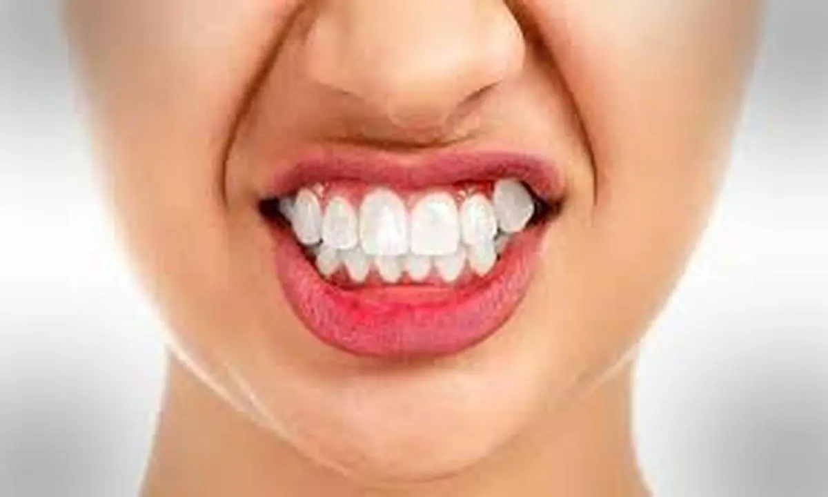هفت کاری که دندان هایتان را نابود میکند | از انجام این کار ها اجتناب کنید 