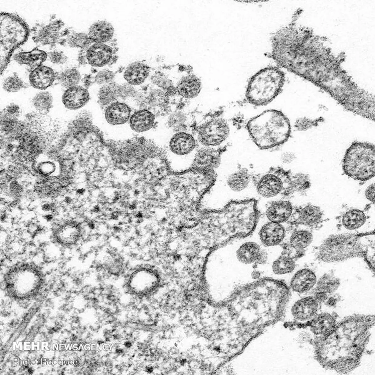 کرونا ویروس زیر میکروسکوپ