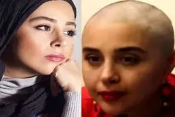  بازیگر جوان ایرانی به سرطان مبتلا شد