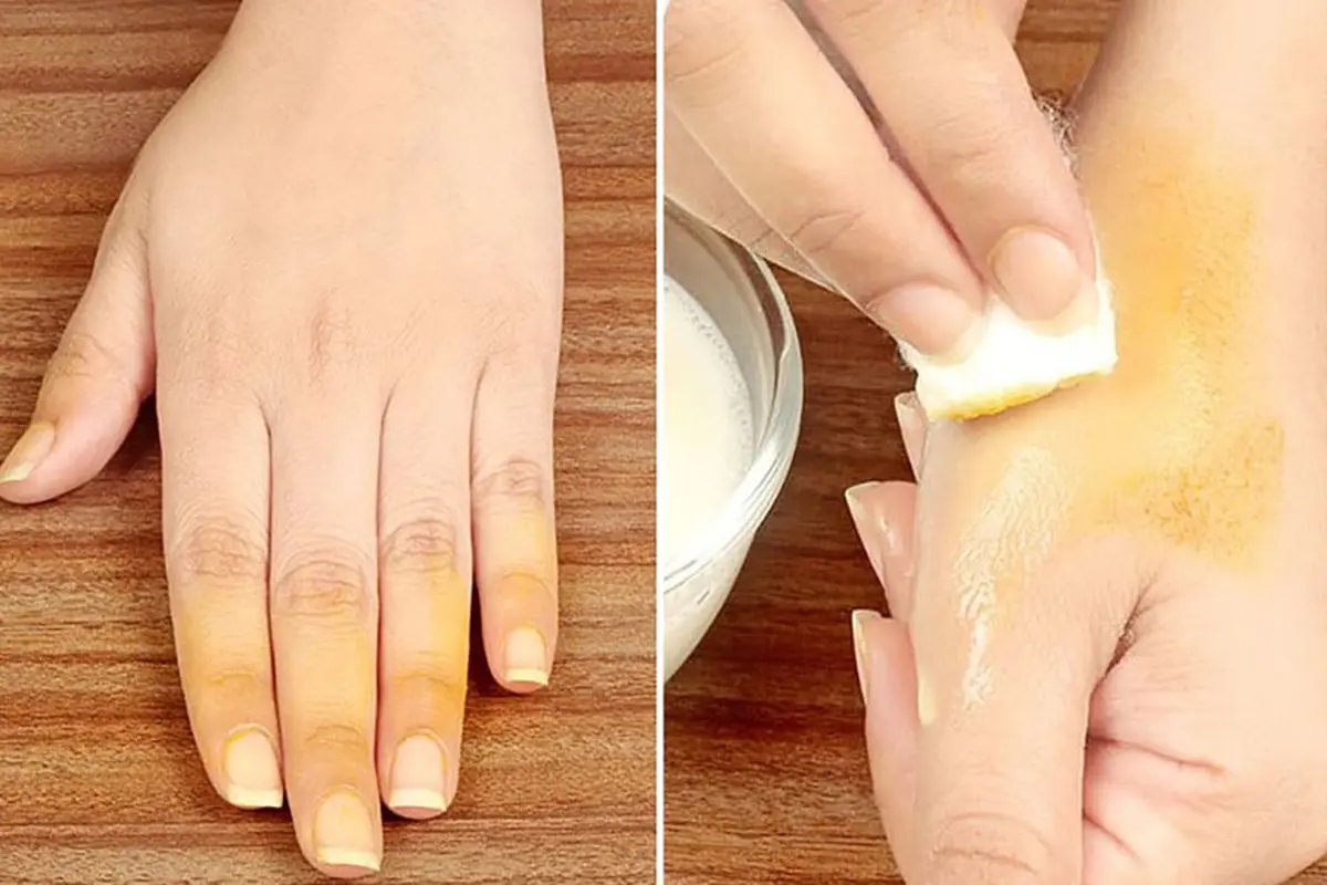 اگر لکه زردچوبه روی ناخنت مونده با این روش سه سوته پاکش کن! | ترفند  پاک کردن لکه زردچوبه از روی دست و ناخن + ویدئو