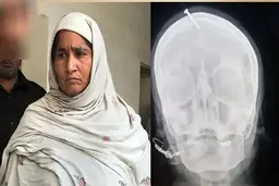 کار عجیب یک رمال | فرو کردن میخ بر سر یک زن به دلیل دخترزا بودن