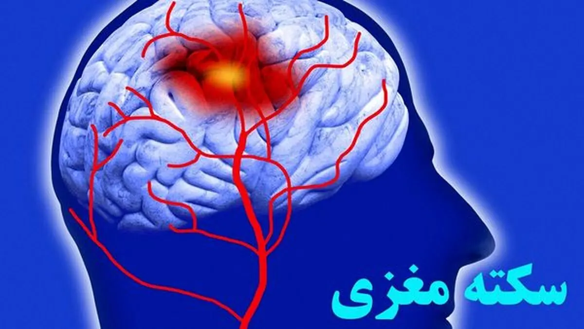 اینها نشانه سکته مغزی هستند! 
