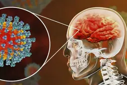 ویروس کرونا به داخل بافت مغز هم می رود!
