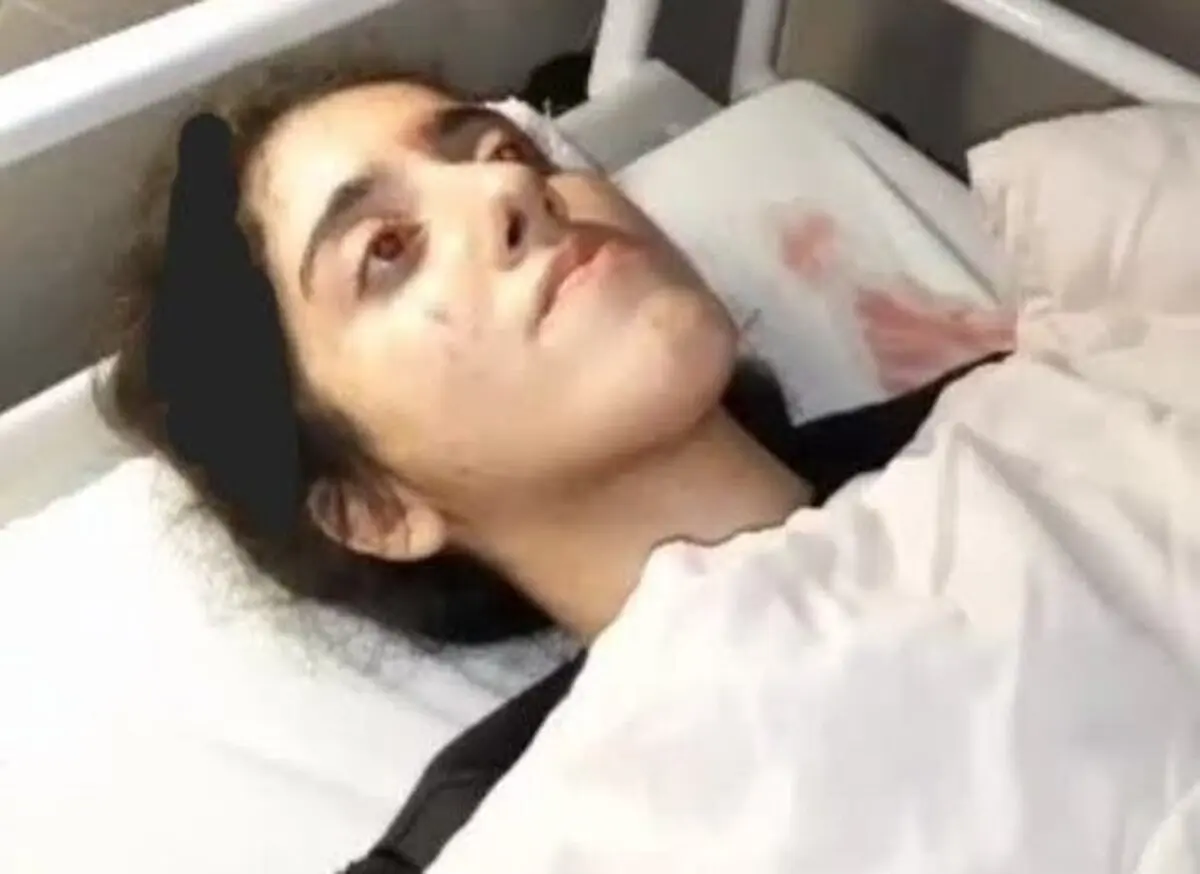 پلیس کشته شدن دختر جوان رشتی را تکذیب کرد | فرمانده انتظامی: او از ناحیه سر دچار آسیب شده