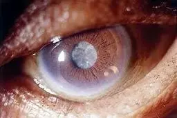 دیابت این اندام های بدن را بیمار می کند 