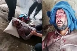 واکنش زاکانی به احتمال خودزنی شهردار ناحیه۳منطقه۱۹ +ویدئو