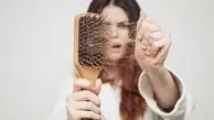 مصرف این ۳ خوراکی باعث ریزش مو می شود