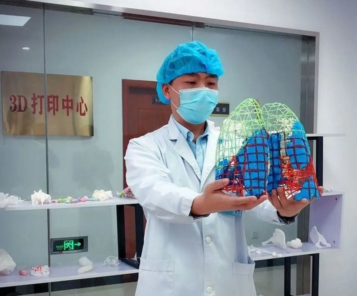 ماکت ریه آلوده به کرونا در چین ساخته شد 